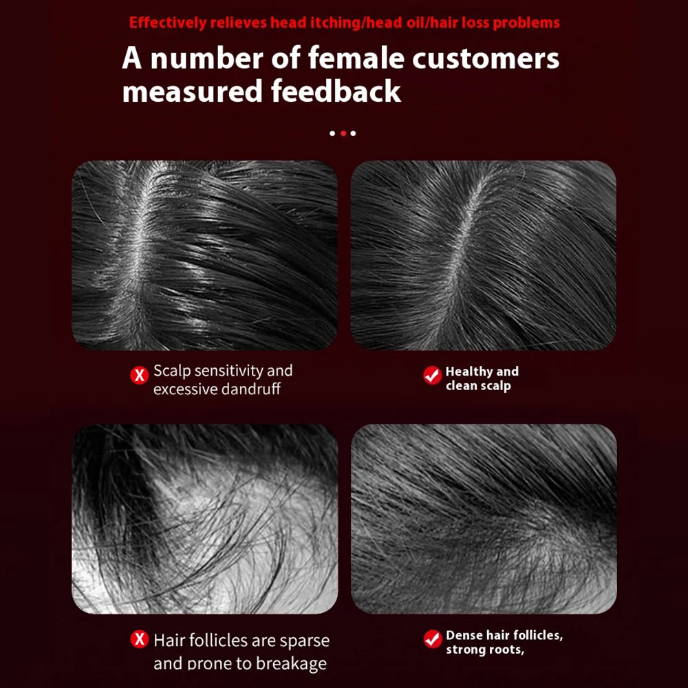 ScalpRevive Hair Massager - Portable electric scalp massager for hair growth and anti-hair loss care.