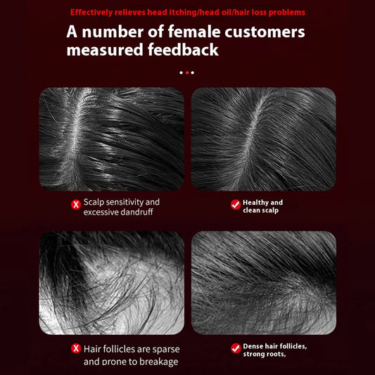 ScalpRevive Hair Massager - Portable electric scalp massager for hair growth and anti-hair loss care.